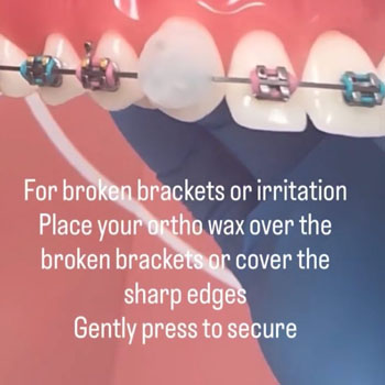 Marvel Orthodontics Instagram Marvel Orthodontics Instagram