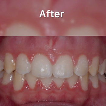 Marvel Orthodontics Instagram Marvel Orthodontics Instagram