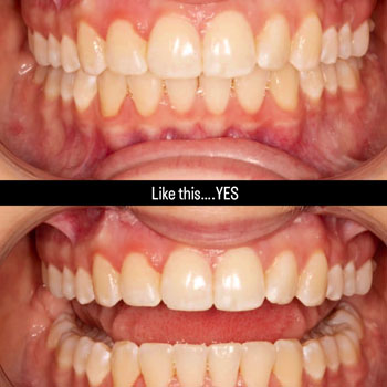 Marvel Orthodontics Instagram Marvel Orthodontics Instagram